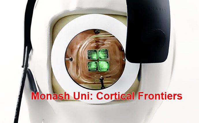 Cortical Vision Device Monash Vision Group