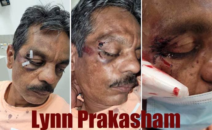 Indian family attacked in Lynbrook - Lynn Prakasham