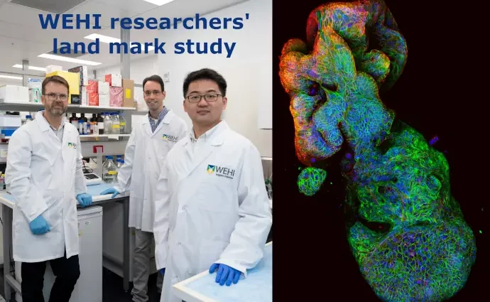 WEHI Researchers with tumour image